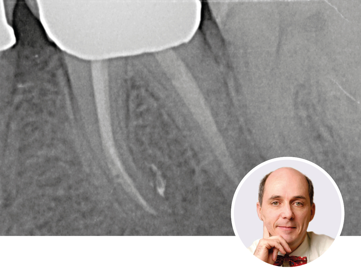 Moderne Endodontologie für den Allgemeinpraktiker