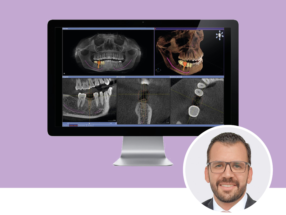 Endo Friday Meeting - Modul I