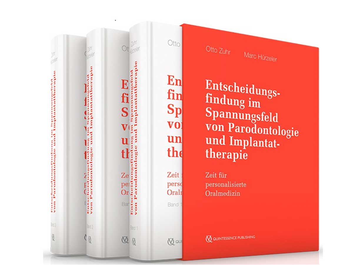 Buch Zuhr/ Hürzeler Entscheidungsfindung im Spannungsfeld von Parpdontologie & Implanttherapie