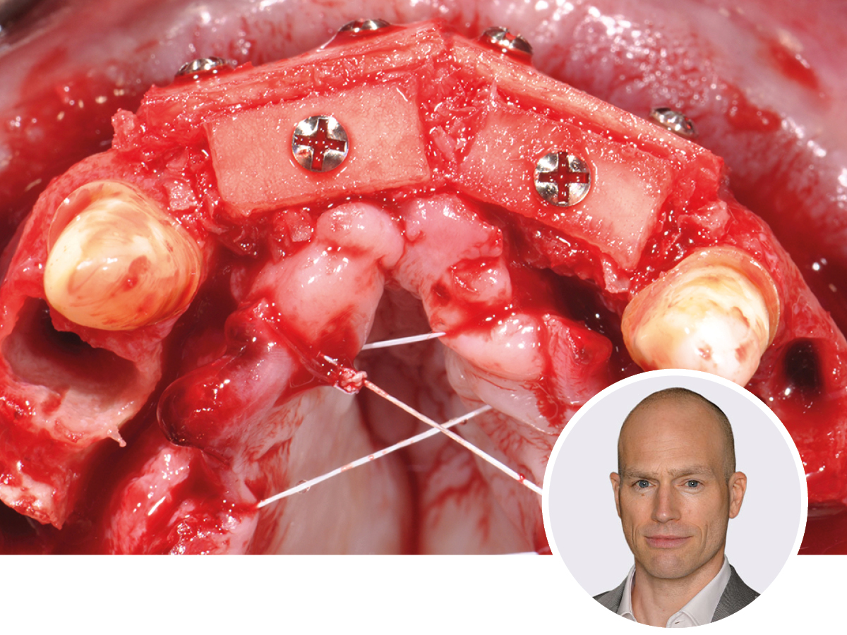 Simplify your Augmentation: Prinzipien-Konzepte-Techniken